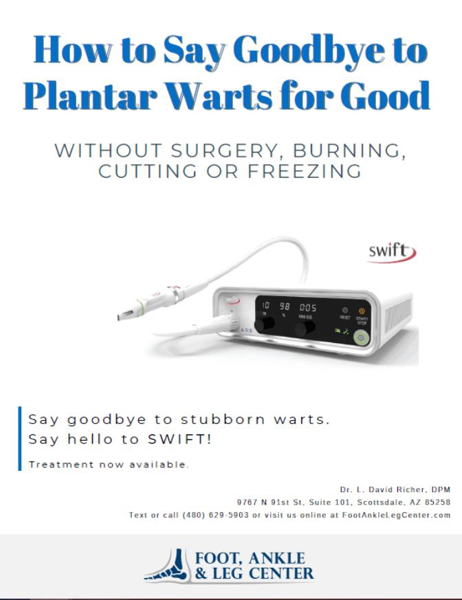 How to Say Goodbye to Plantar Warts for Good